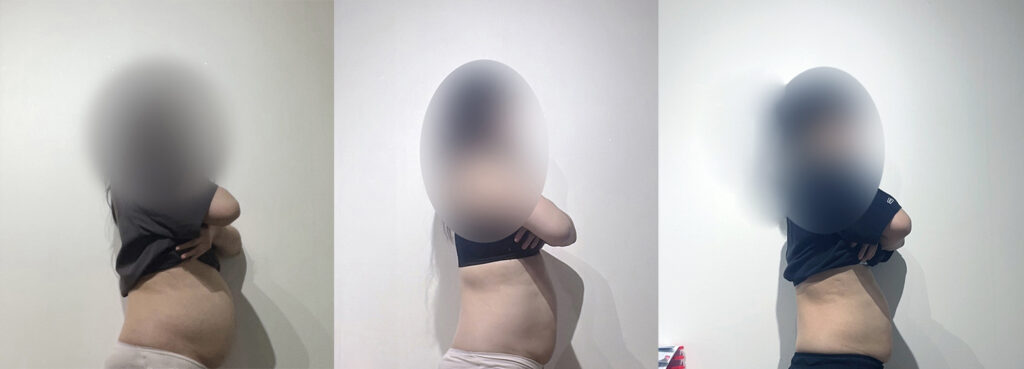 마운자로 8주차 후기 배둘레 변화